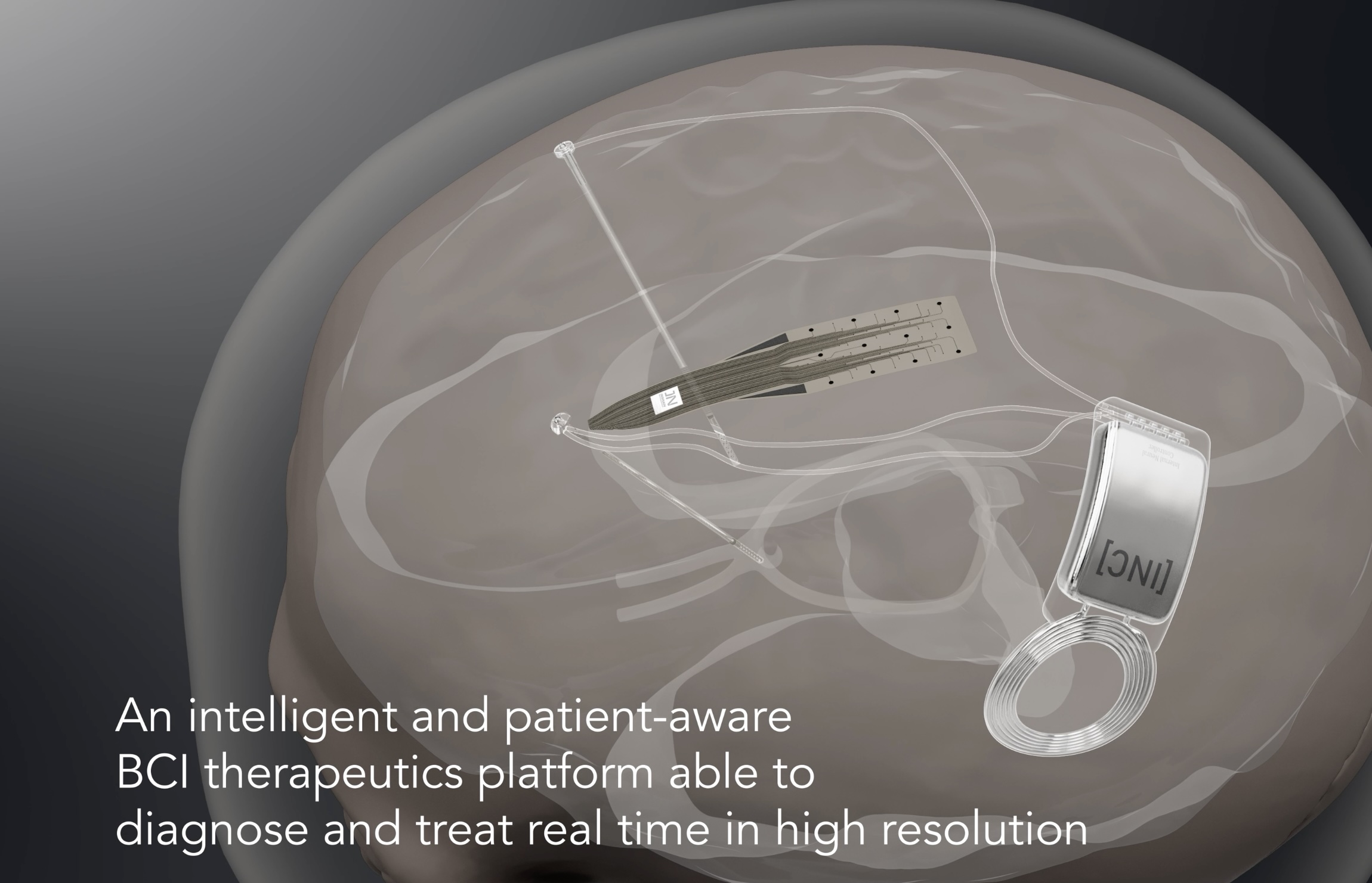 INBRAIN Neuroelectronics Raises $50M Series B to Advance Graphene-Based Brain-Computer Interface Technology